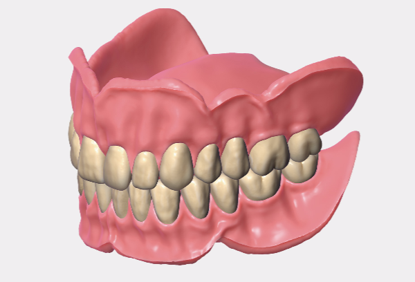 Dental Technology, 3D printer Carbon M2, Dental Equipment