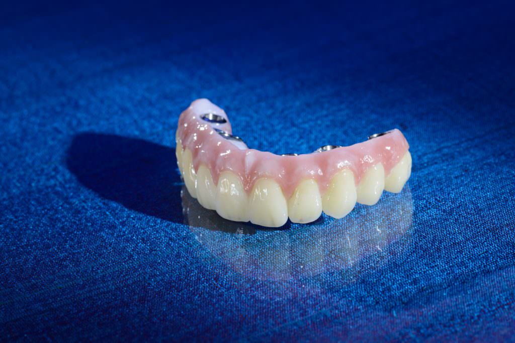 High strength monolithic zirconias ideal for use in full and single crowns and bridges